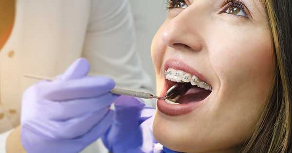 The best orthodontists in Canberra