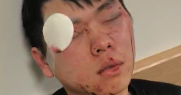 Gang attacks Chinese students in race-hate bashings at Woden Interchange
