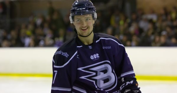 Behind the Brave Face: Q&A with Bayley Kubara