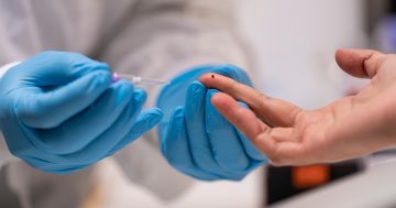 Surgery saves neuroscience as ANU College completes cost-cutting revamp