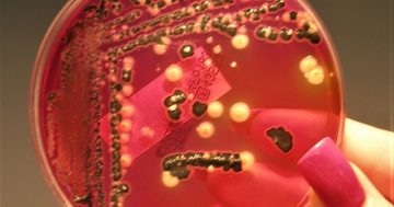 ACT salmonella rates lowest in Australia, coincide with COVID-19 safety measures