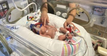 How changing wipes is reducing nappy rash for NICU babies at Canberra Hospital