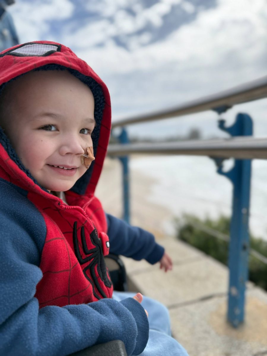 A young child in a Spiderman hoodie with a tube in his nose