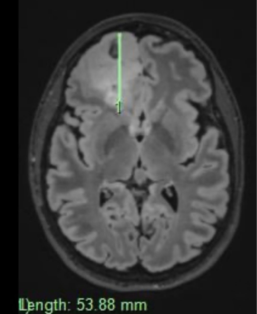 Brain scan