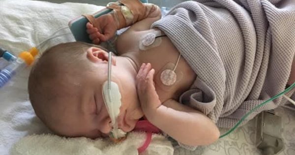 Eligibility for RSV protection needs to match the recommendations, advocates say