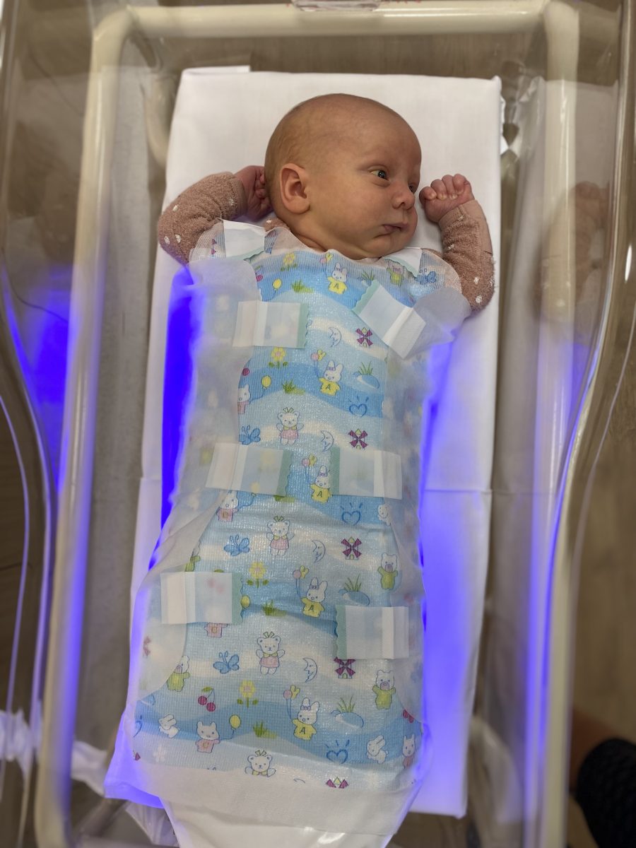 baby using a BiliCocoon